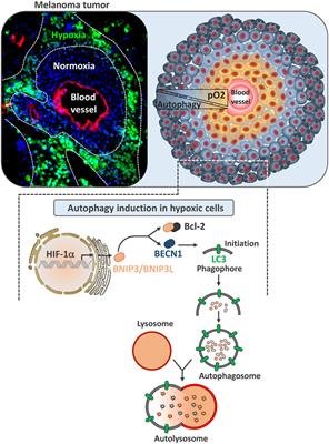 Hijacker of the Antitumor Immune Response: Autophagy Is Showing Its Worst Facet